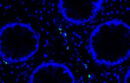 Remnants of COVID-19, green, lingering in the GI tract.