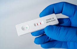 Doctor holding a Positive Result for COVID-19 with test kit for viral disease COVID-19 2019-nCoV.